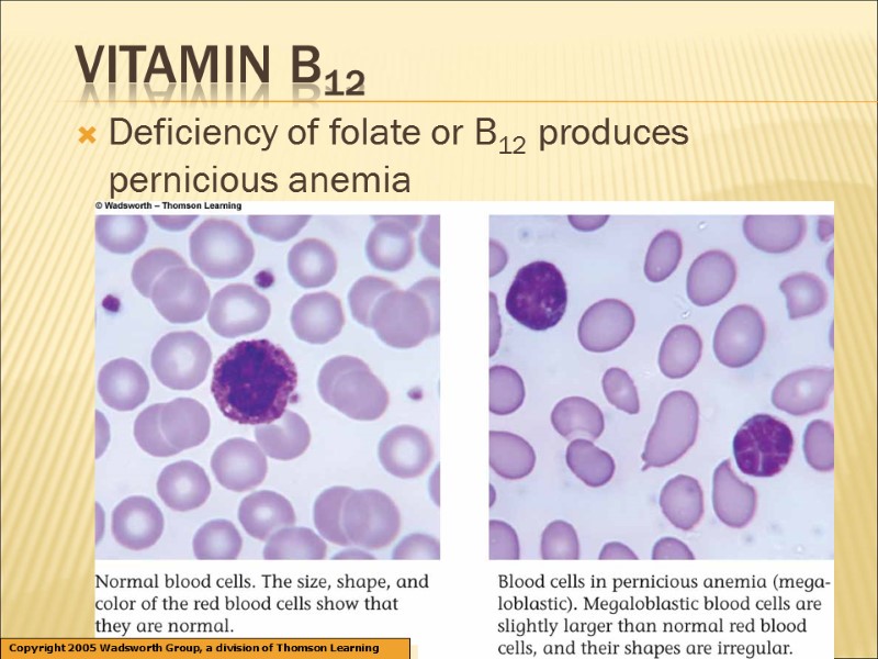 Vitamin B12 Deficiency of folate or B12 produces pernicious anemia Copyright 2005 Wadsworth Group,